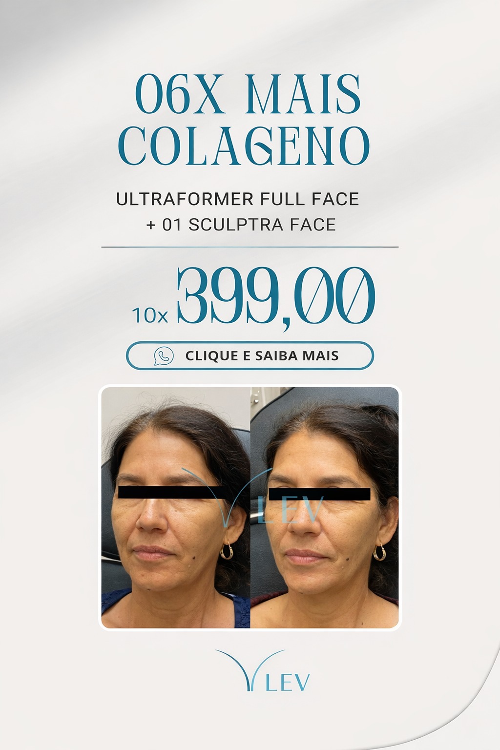 Clínica Lev - Ultraformer